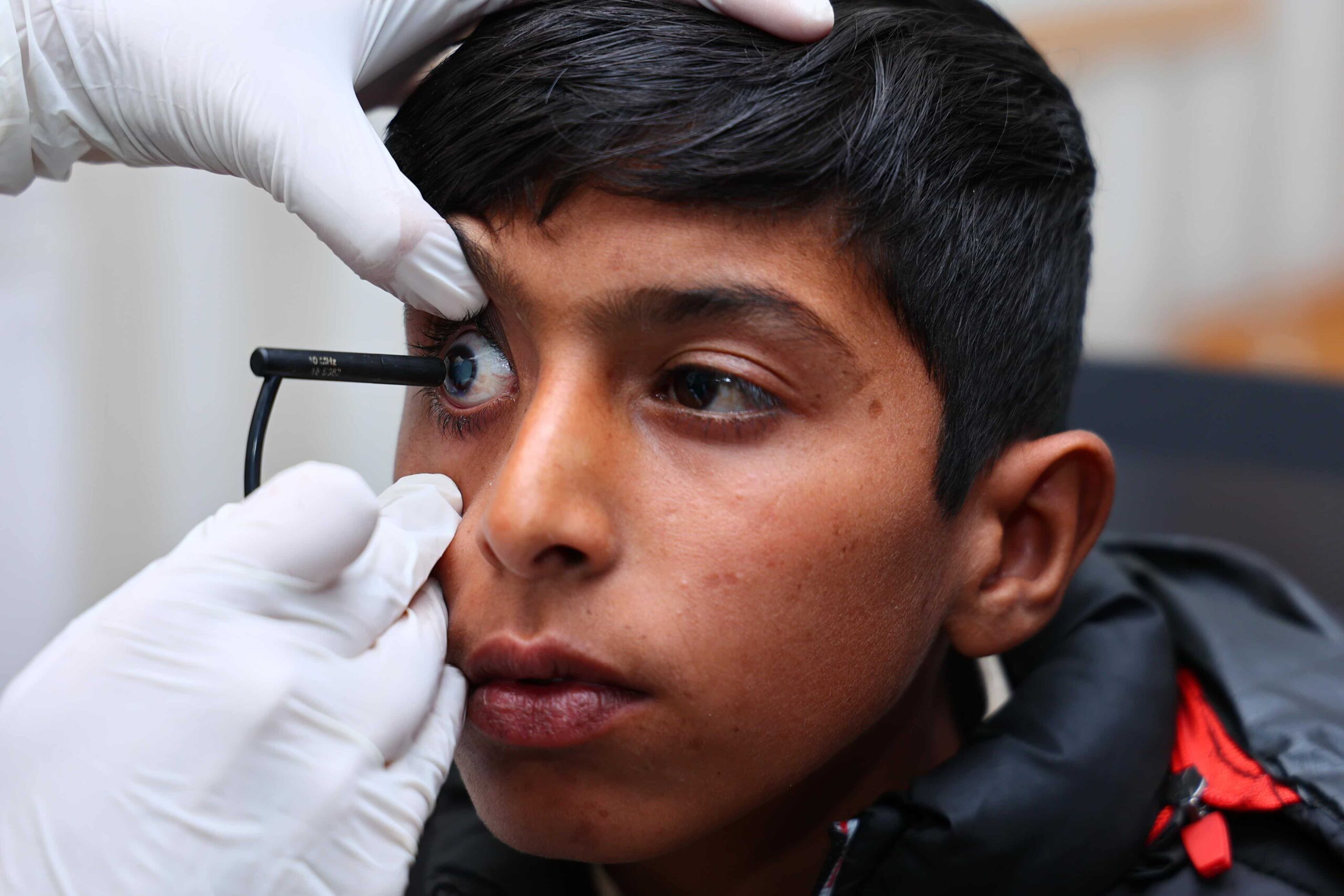 Improving Lives Through Clean Water and Eye Care: The Impact of Collaboration with a Renowned Charity